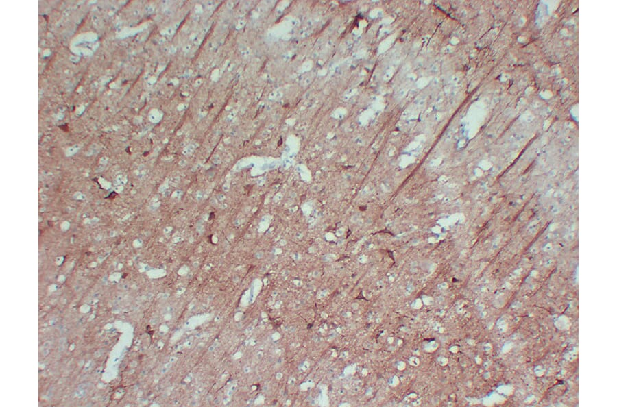 Immunohistochemistry - Anti-Neurofilament Antibody (V0103) - Antibodies.com