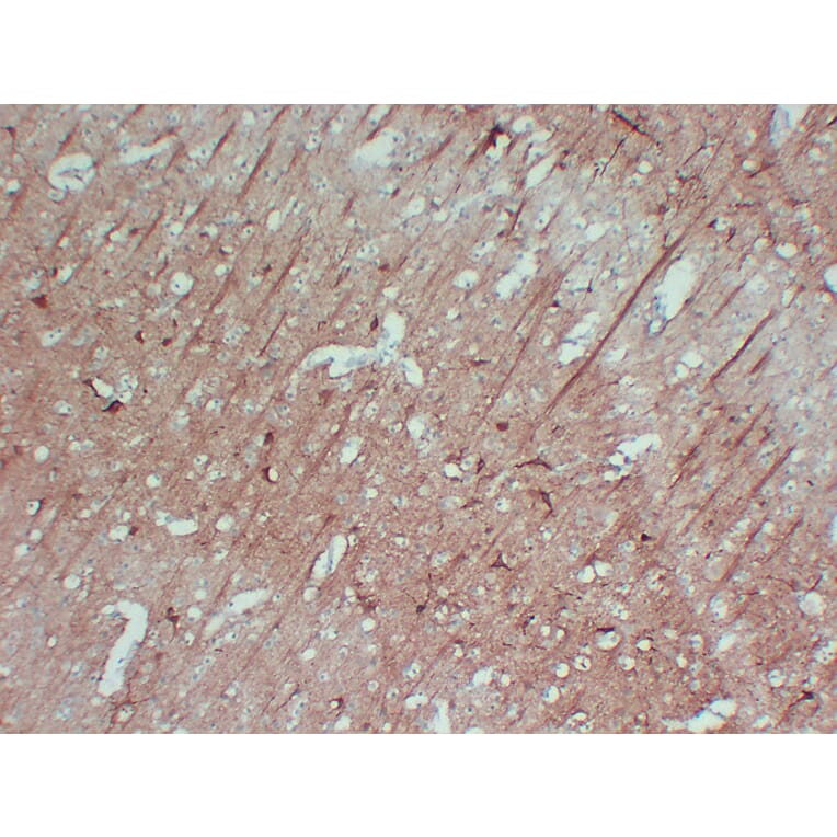 Immunohistochemistry - Anti-Neurofilament Antibody (V0103) - Antibodies.com