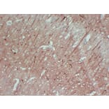 Immunohistochemistry - Anti-Neurofilament Antibody (V0103) - Antibodies.com