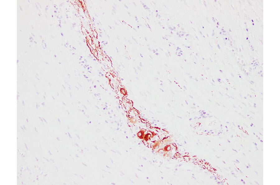 Immunohistochemistry - Anti-Neurofilament Antibody (V0103) - Antibodies.com