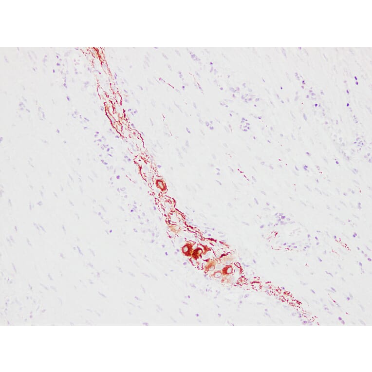 Immunohistochemistry - Anti-Neurofilament Antibody (V0103) - Antibodies.com