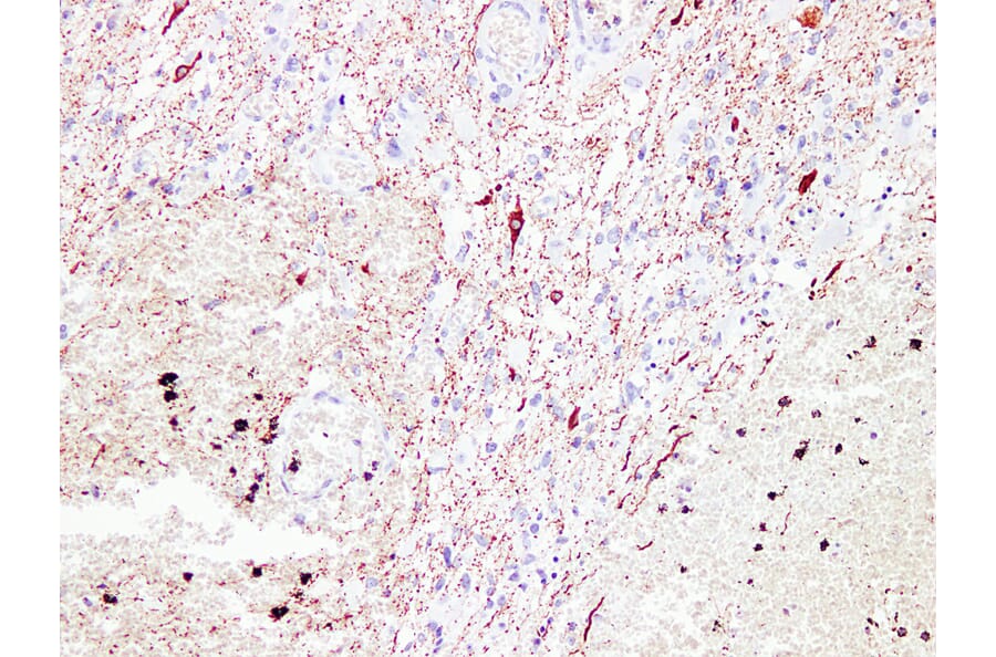 Immunohistochemistry - Anti-Neurofilament Antibody (V0103) - Antibodies.com