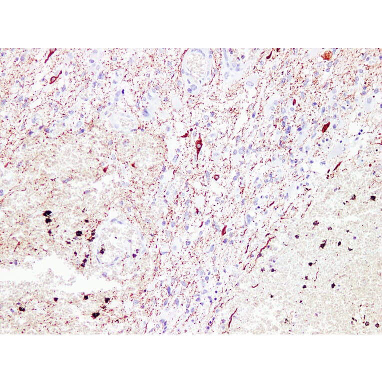 Immunohistochemistry - Anti-Neurofilament Antibody (V0103) - Antibodies.com