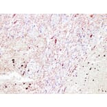 Immunohistochemistry - Anti-Neurofilament Antibody (V0103) - Antibodies.com