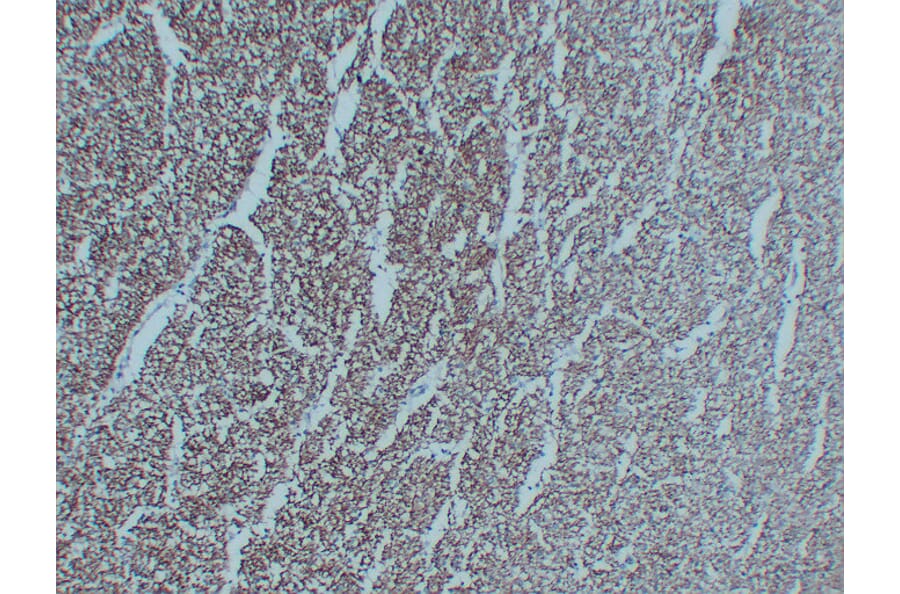 Immunohistochemistry - Anti-Neurofilament Antibody (V0103) - Antibodies.com