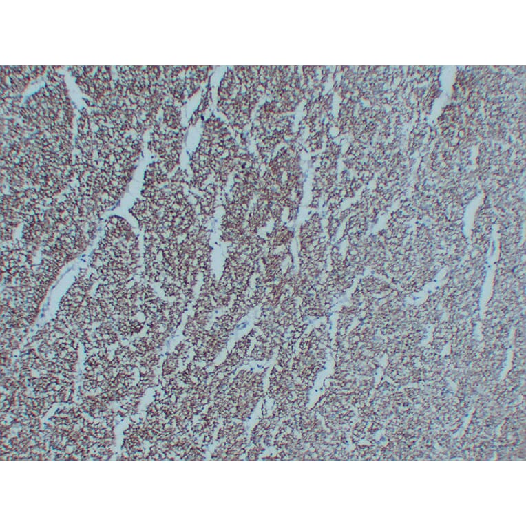 Immunohistochemistry - Anti-Neurofilament Antibody (V0103) - Antibodies.com