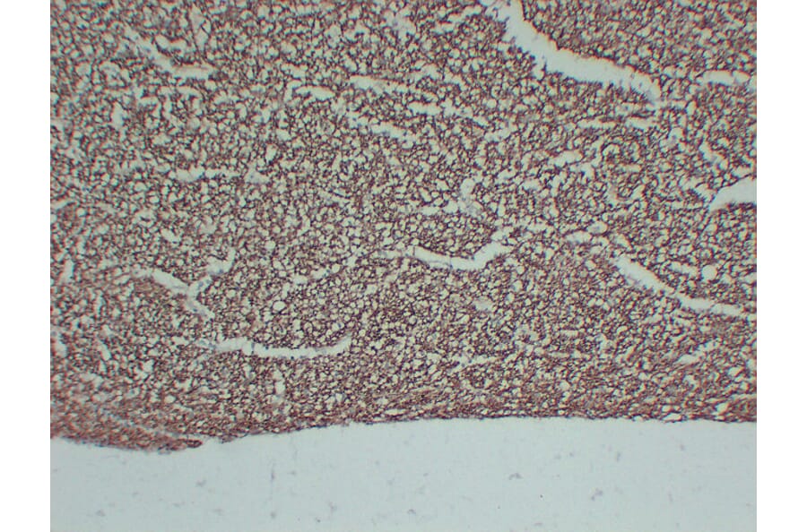 Immunohistochemistry - Anti-Neurofilament Antibody (V0103) - Antibodies.com