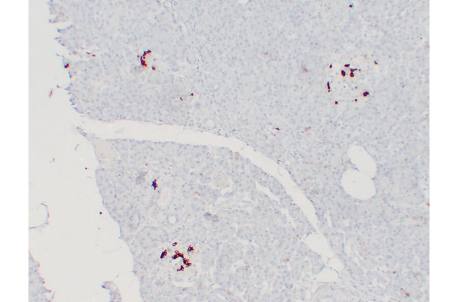 Immunohistochemistry - Anti-Somatostatin Antibody (V0125) - Antibodies.com