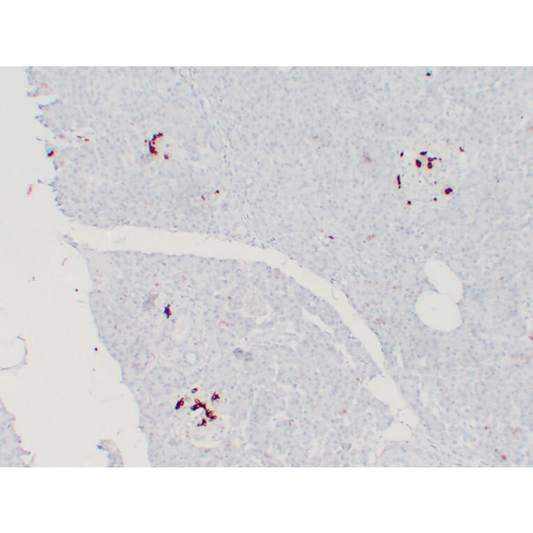 Immunohistochemistry - Anti-Somatostatin Antibody (V0125) - Antibodies.com