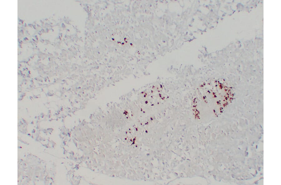 Immunohistochemistry - Anti-Somatostatin Antibody (V0125) - Antibodies.com