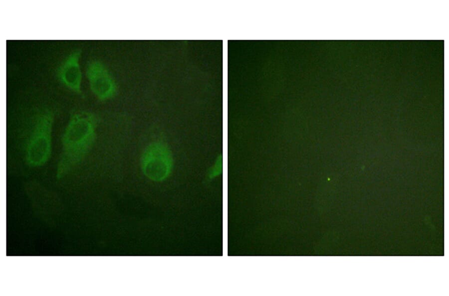 Immunofluorescence - Anti-IL-2R alpha Antibody (B1061) - Antibodies.com