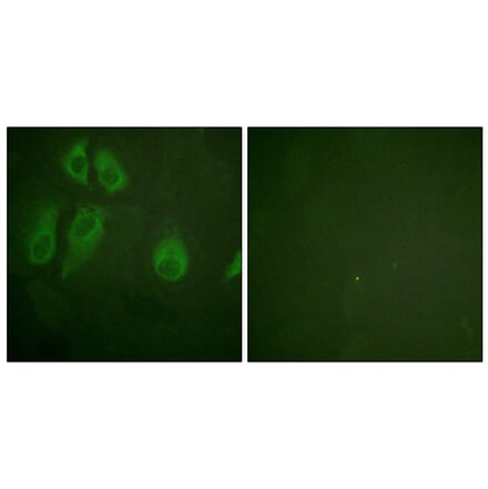 Immunofluorescence - Anti-IL-2R alpha Antibody (B1061) - Antibodies.com