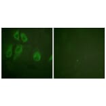 Immunofluorescence - Anti-IL-2R alpha Antibody (B1061) - Antibodies.com