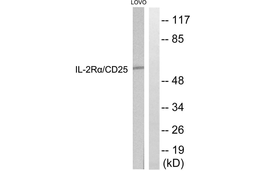 Western Blot - Anti-IL-2R alpha Antibody (B1061) - Antibodies.com