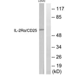 Western Blot - Anti-IL-2R alpha Antibody (B1061) - Antibodies.com