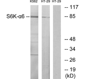 Western Blot - Anti-S6K-alpha6 Antibody (C11866) - Antibodies.com