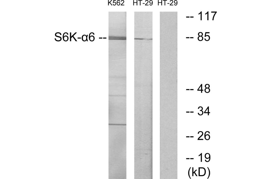 Western Blot - Anti-S6K-alpha6 Antibody (C11866) - Antibodies.com
