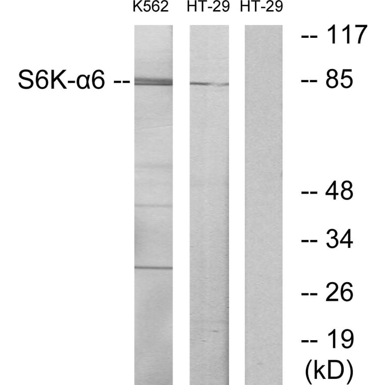 Western Blot - Anti-S6K-alpha6 Antibody (C11866) - Antibodies.com