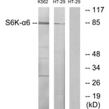 Western Blot - Anti-S6K-alpha6 Antibody (C11866) - Antibodies.com