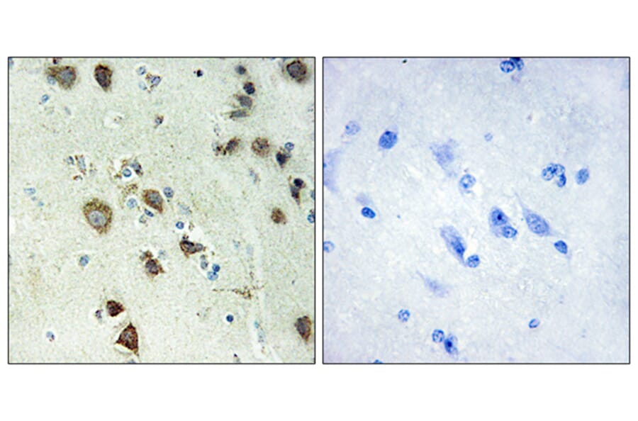 Immunohistochemistry - Anti-S6K-alpha6 Antibody (C11866) - Antibodies.com