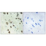 Immunohistochemistry - Anti-S6K-alpha6 Antibody (C11866) - Antibodies.com