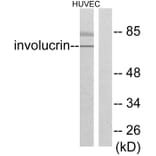 Western Blot - Anti-Involucrin Antibody (C0236) - Antibodies.com