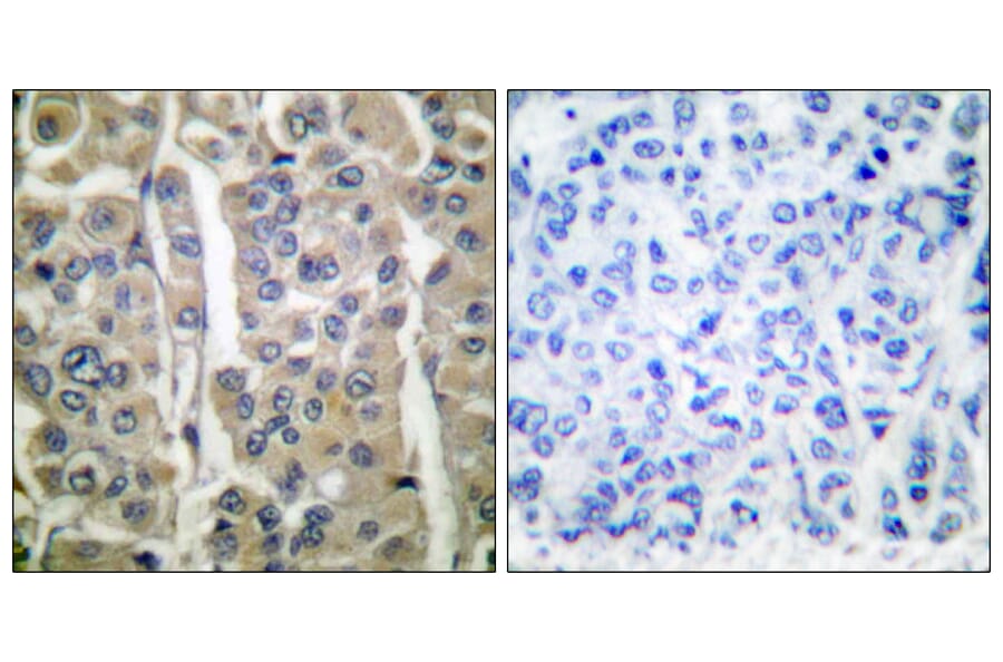 Immunohistochemistry - Anti-Involucrin Antibody (C0236) - Antibodies.com