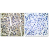 Immunohistochemistry - Anti-Involucrin Antibody (C0236) - Antibodies.com