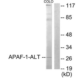 Western Blot - Anti-APAF-1-ALT Antibody (C0128) - Antibodies.com
