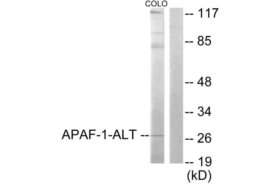 Western Blot - Anti-APAF-1-ALT Antibody (C0128) - Antibodies.com