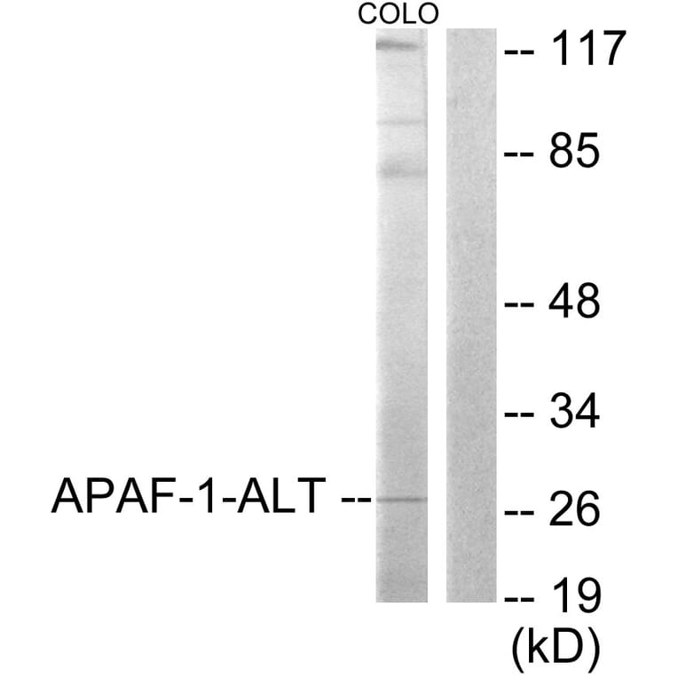 Western Blot - Anti-APAF-1-ALT Antibody (C0128) - Antibodies.com