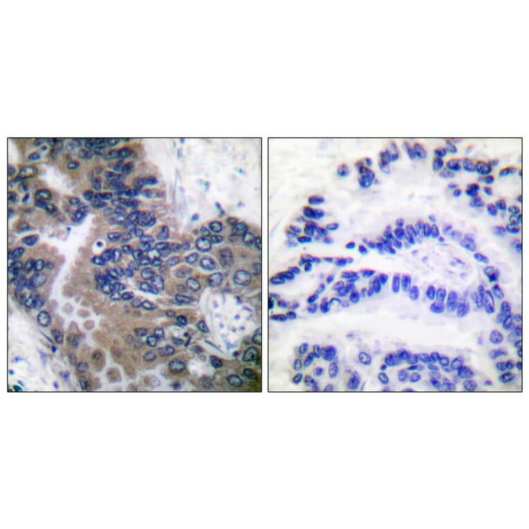 Immunohistochemistry - Anti-APAF-1-ALT Antibody (C0128) - Antibodies.com