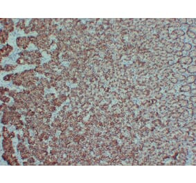 Immunohistochemistry - Anti-Claudin 18 Antibody (V0059) - Antibodies.com