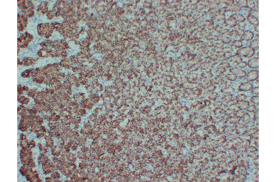 Immunohistochemistry - Anti-Claudin 18 Antibody (V0059) - Antibodies.com