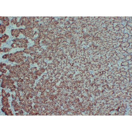 Immunohistochemistry - Anti-Claudin 18 Antibody (V0059) - Antibodies.com