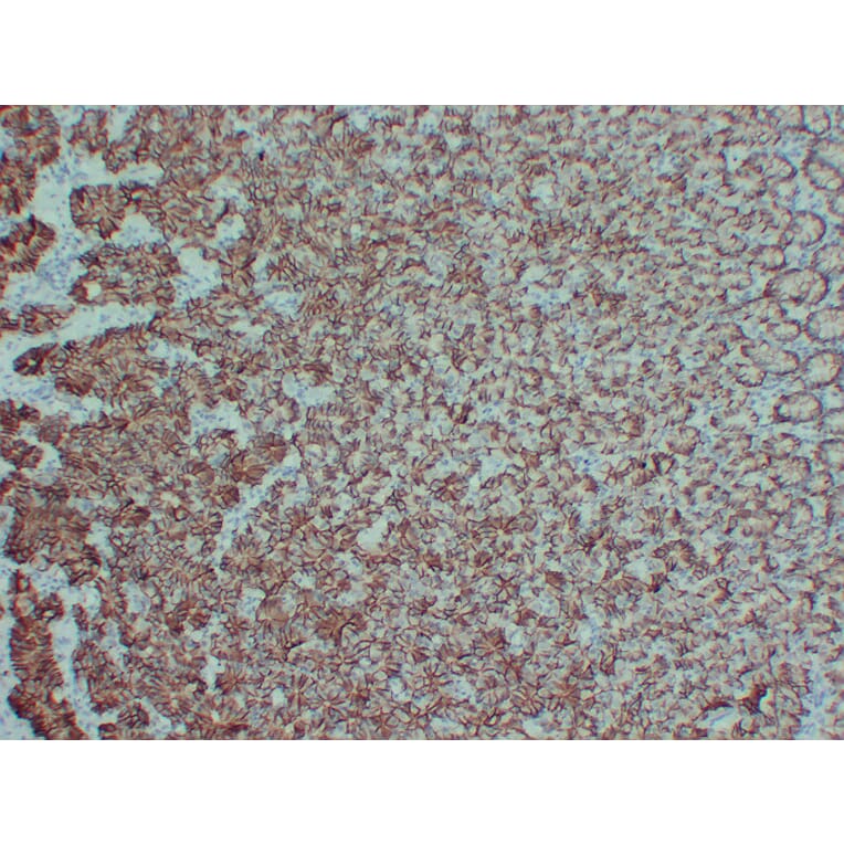 Immunohistochemistry - Anti-Claudin 18 Antibody (V0059) - Antibodies.com