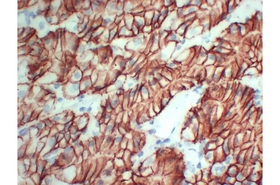 Immunohistochemistry - Anti-Claudin 18 Antibody (V0059) - Antibodies.com