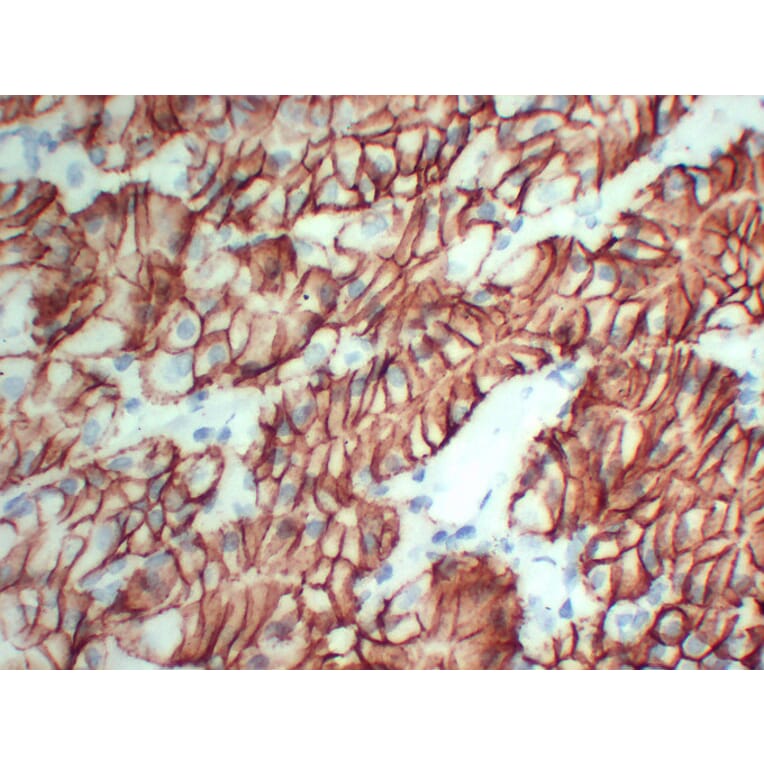 Immunohistochemistry - Anti-Claudin 18 Antibody (V0059) - Antibodies.com