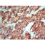 Immunohistochemistry - Anti-Claudin 18 Antibody (V0059) - Antibodies.com