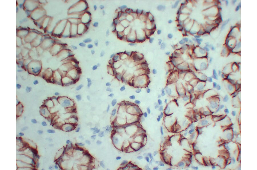 Immunohistochemistry - Anti-Claudin 18 Antibody (V0059) - Antibodies.com