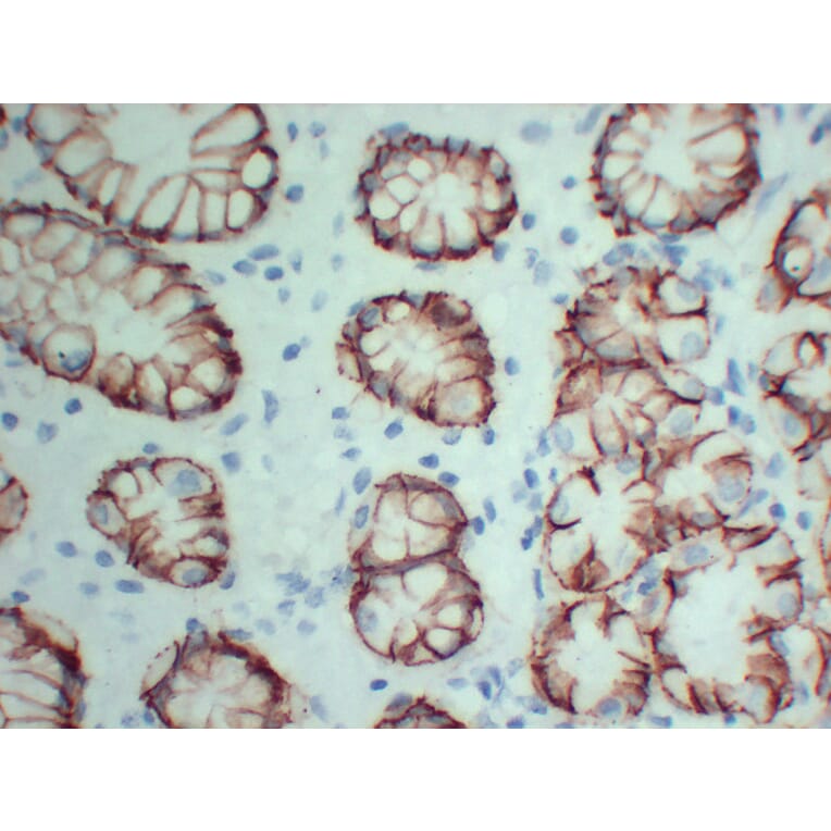 Immunohistochemistry - Anti-Claudin 18 Antibody (V0059) - Antibodies.com