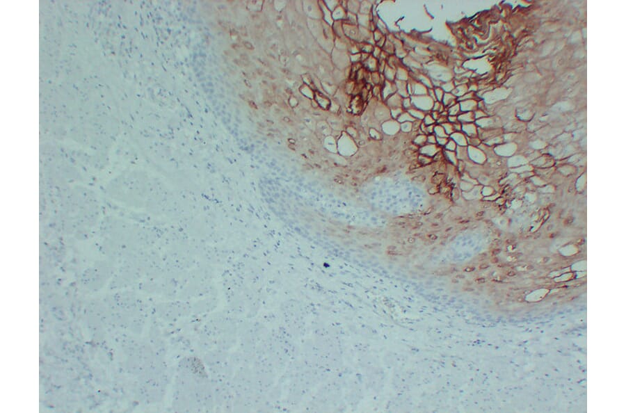 Immunohistochemistry - Anti-Annexin A1 Antibody (V0008) - Antibodies.com