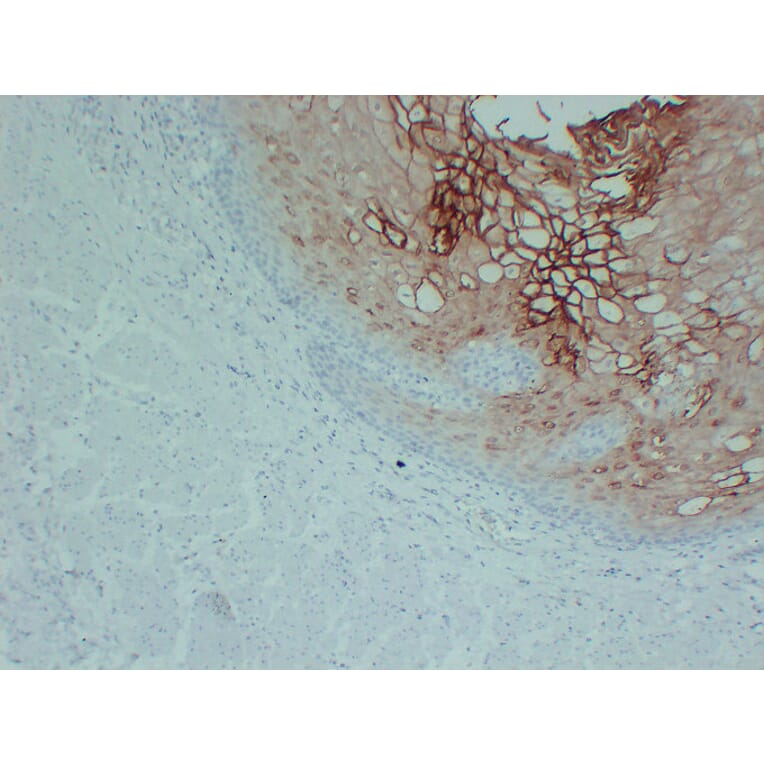 Immunohistochemistry - Anti-Annexin A1 Antibody (V0008) - Antibodies.com