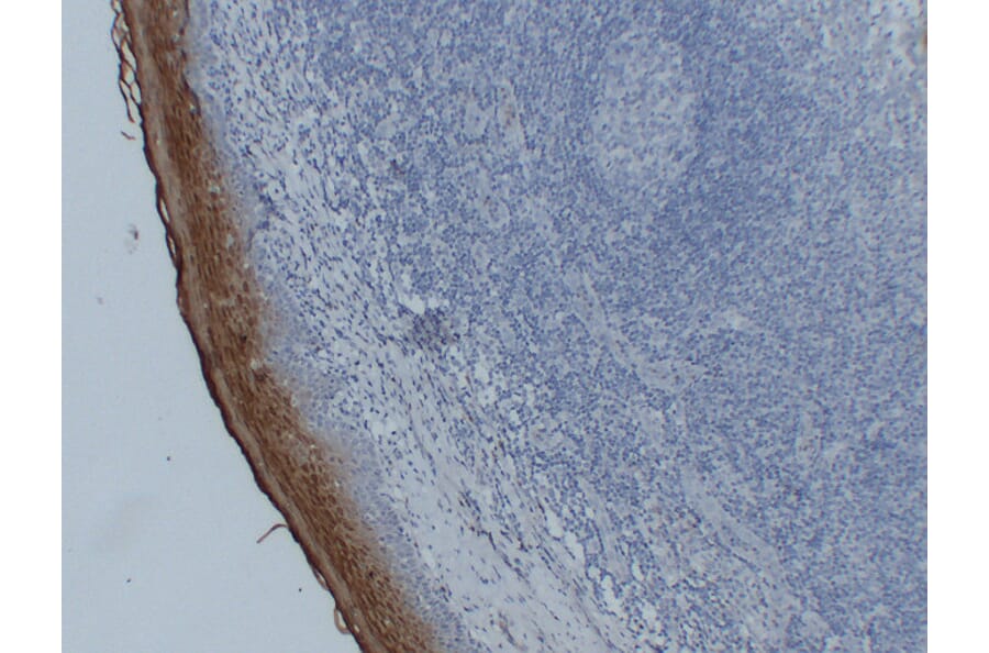 Immunohistochemistry - Anti-Annexin A1 Antibody (V0008) - Antibodies.com