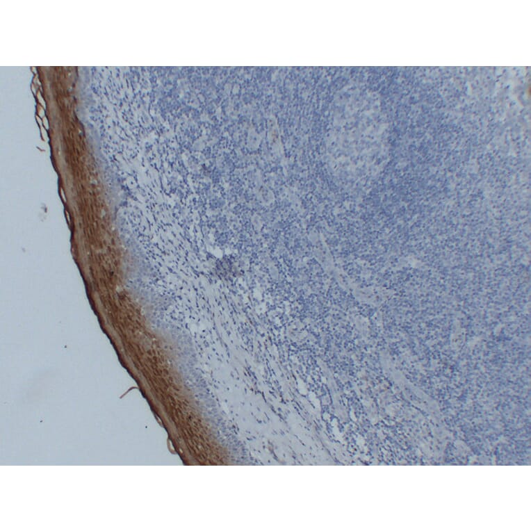 Immunohistochemistry - Anti-Annexin A1 Antibody (V0008) - Antibodies.com