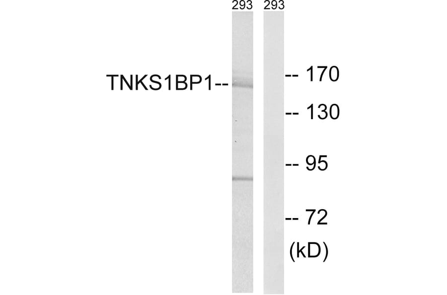 Western Blot - Anti-TNKS1BP1 Antibody (C14002) - Antibodies.com