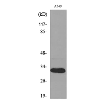 Western Blot - Anti-TNFSF13B Antibody (C30069) - Antibodies.com