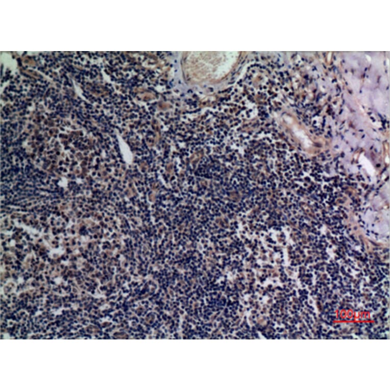Immunohistochemistry - Anti-TNFSF13B Antibody (C30069) - Antibodies.com