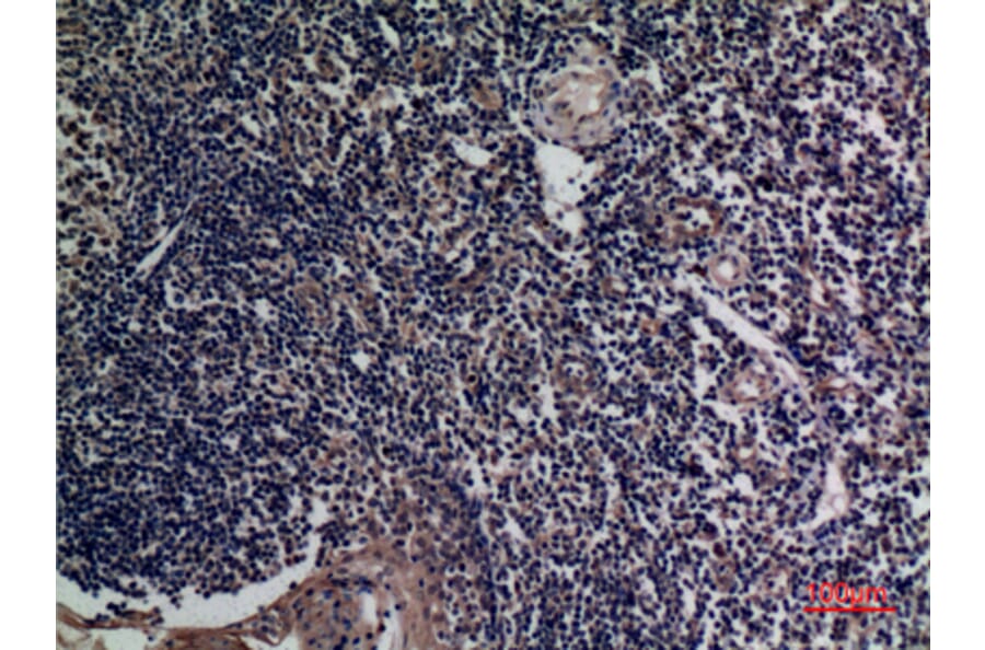 Immunohistochemistry - Anti-TNFSF13B Antibody (C30069) - Antibodies.com