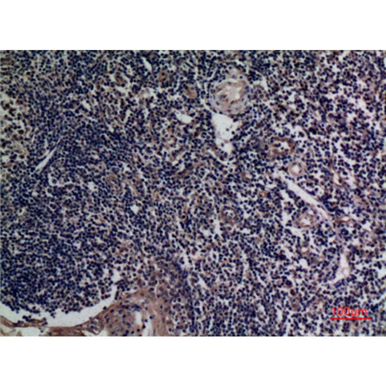 Immunohistochemistry - Anti-TNFSF13B Antibody (C30069) - Antibodies.com